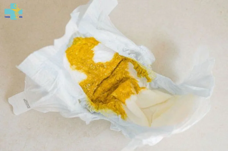 Cách xử lý trẻ bị phân sống
